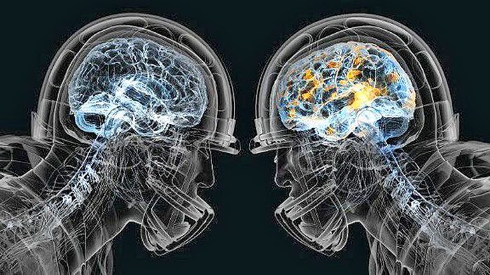 X-ray photo: Of 111 football players in the NFL, from every position on the field — quarterbacks, running backs, linebackers, a place-kicker and a punter—10 were found to have chronic traumatic encephalopathy, the degenerative disease believed to be caused by repeated blows to the head.